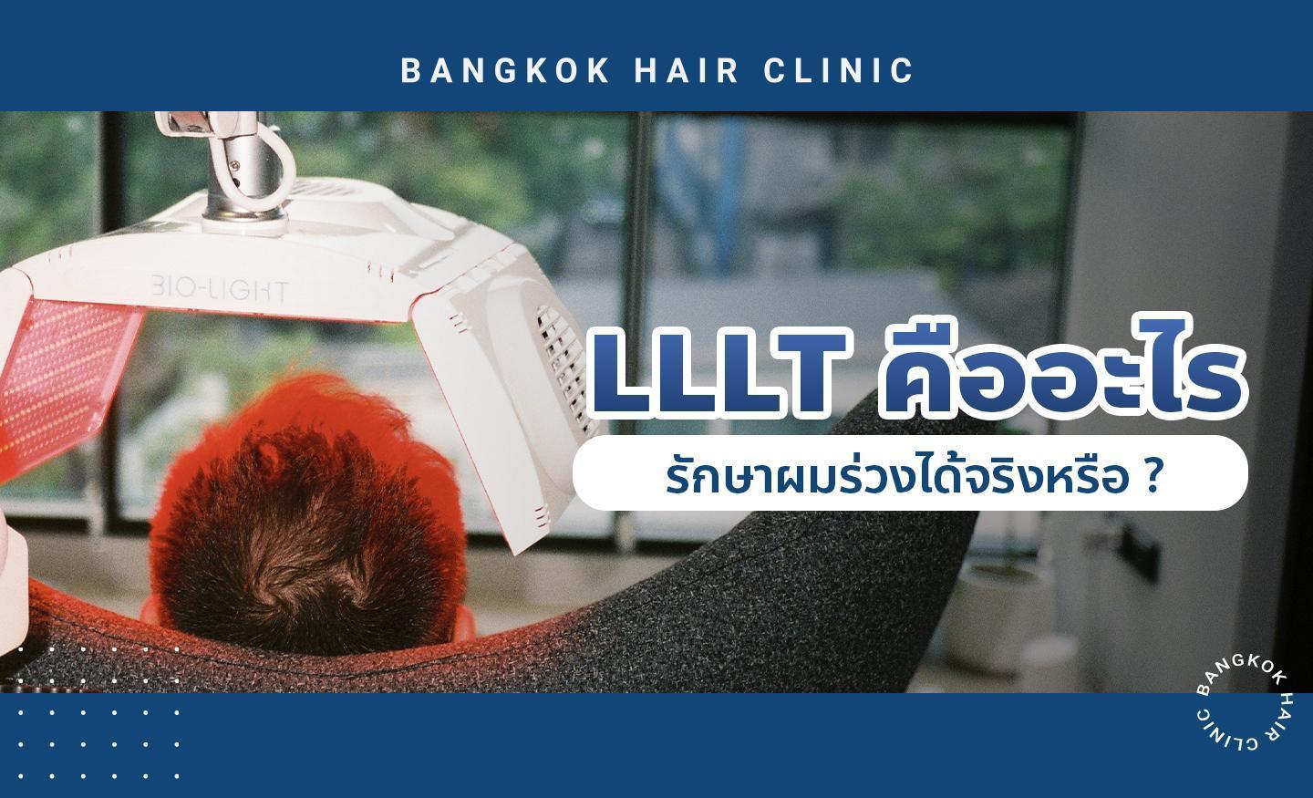 LLLT คืออะไร รักษาผมร่วงได้จริงหรือ ?