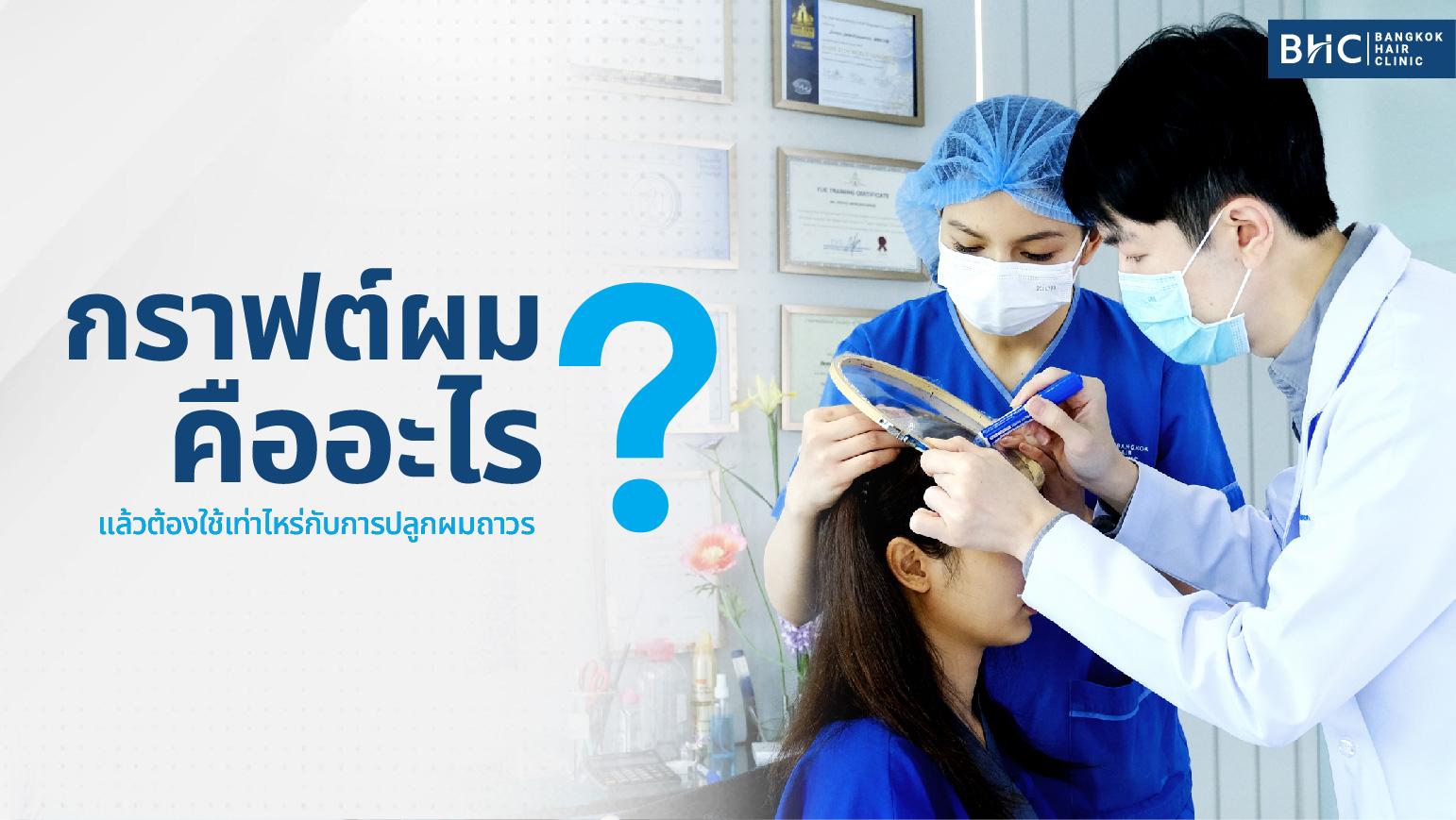 กราฟต์ผม คืออะไร แล้วต้องใช้เท่าไหร่กับการปลูกผมถาวร ?