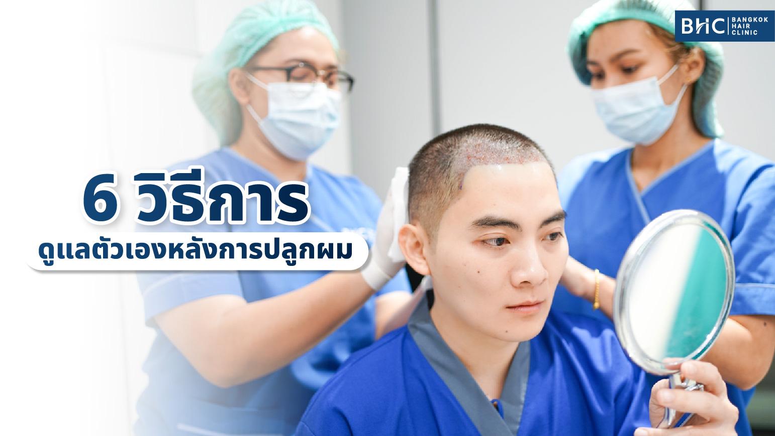 เรื่องนี้ต้องรู้ 6 วิธีการดูแลตัวเองหลังการปลูกผม