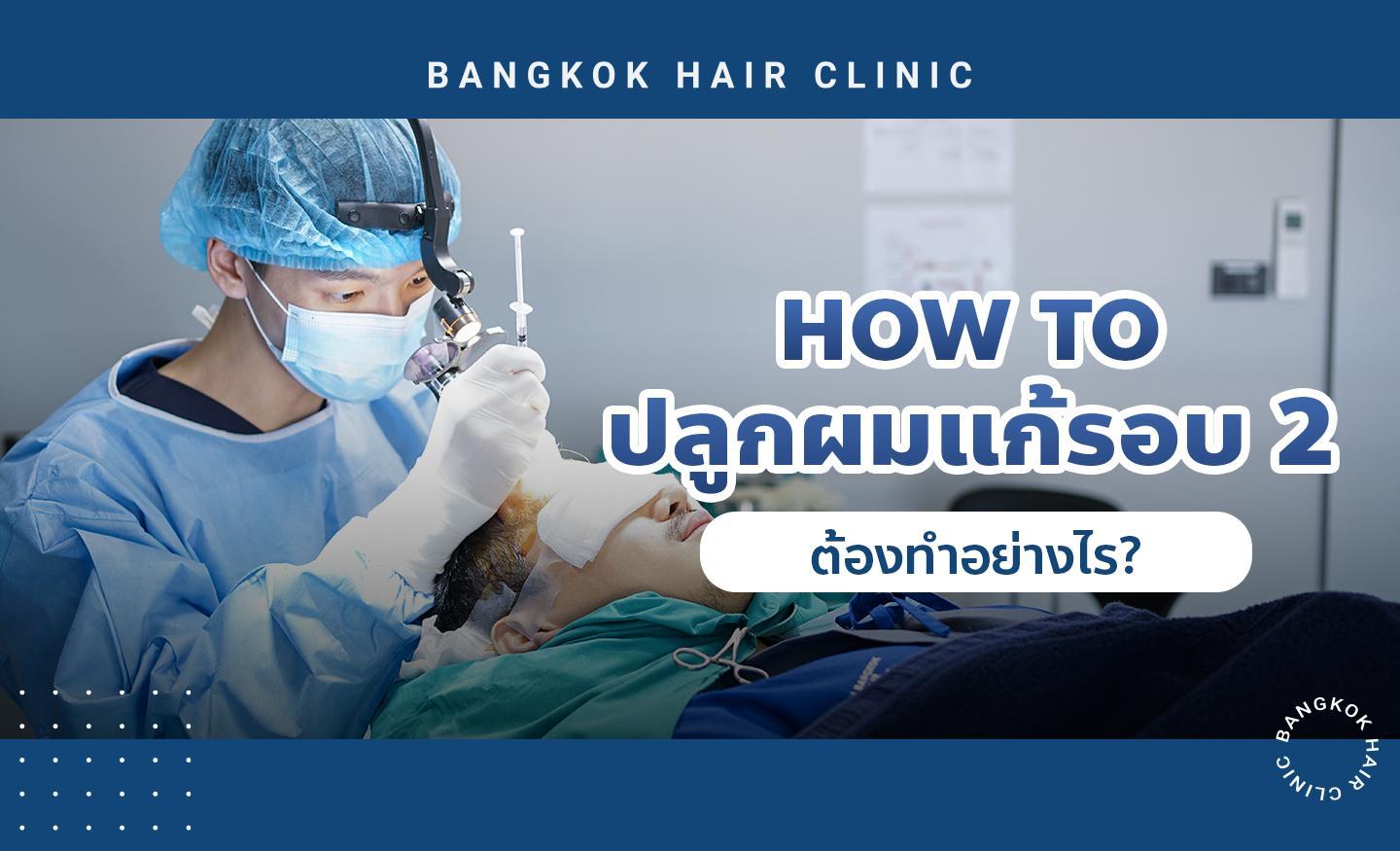 [How to] ปลูกผมแก้รอบสอง ต้องทำอย่างไร?