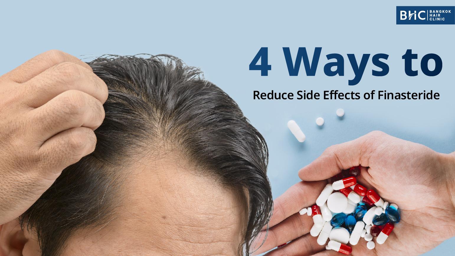 4 Ways to Reduce Side Effects of Finasteride