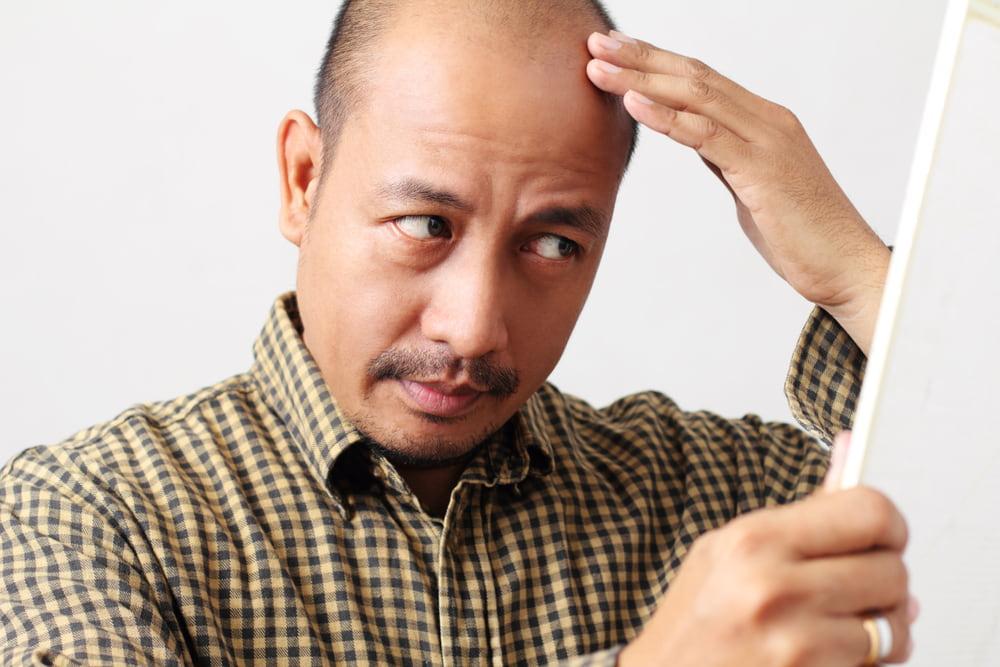 Do Hair Loss Medication Work?