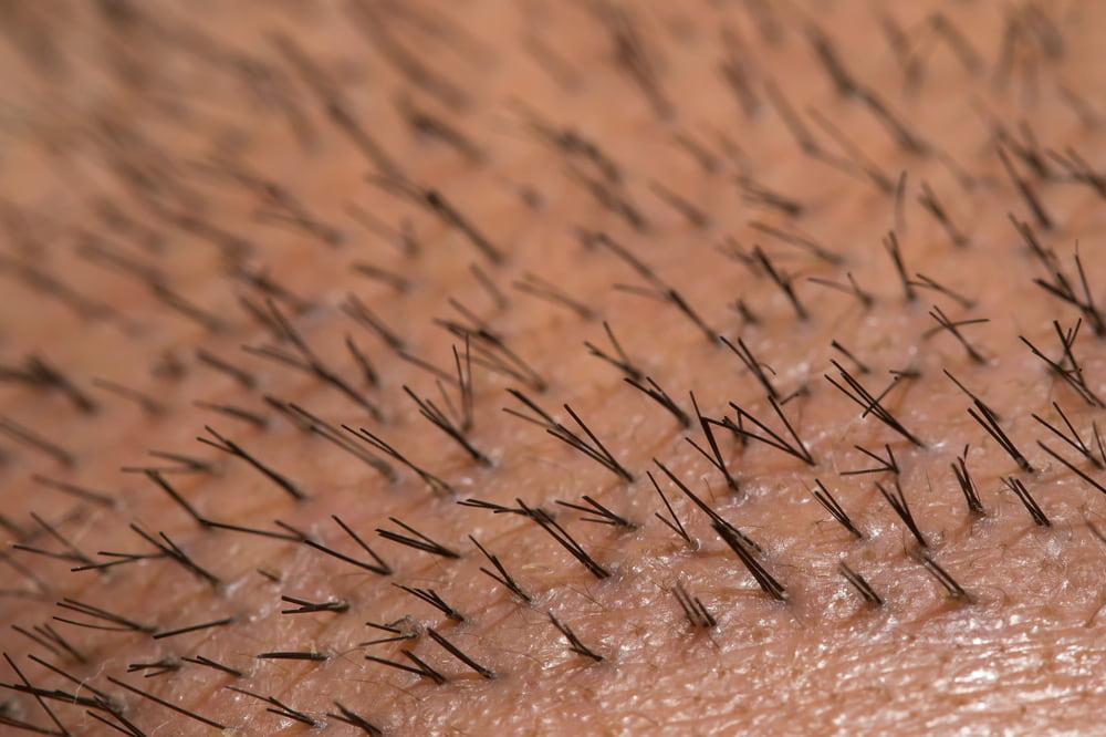 Close-up of hair growing after transplantation